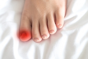 Symptoms and Treatments for Ingrown Toenails